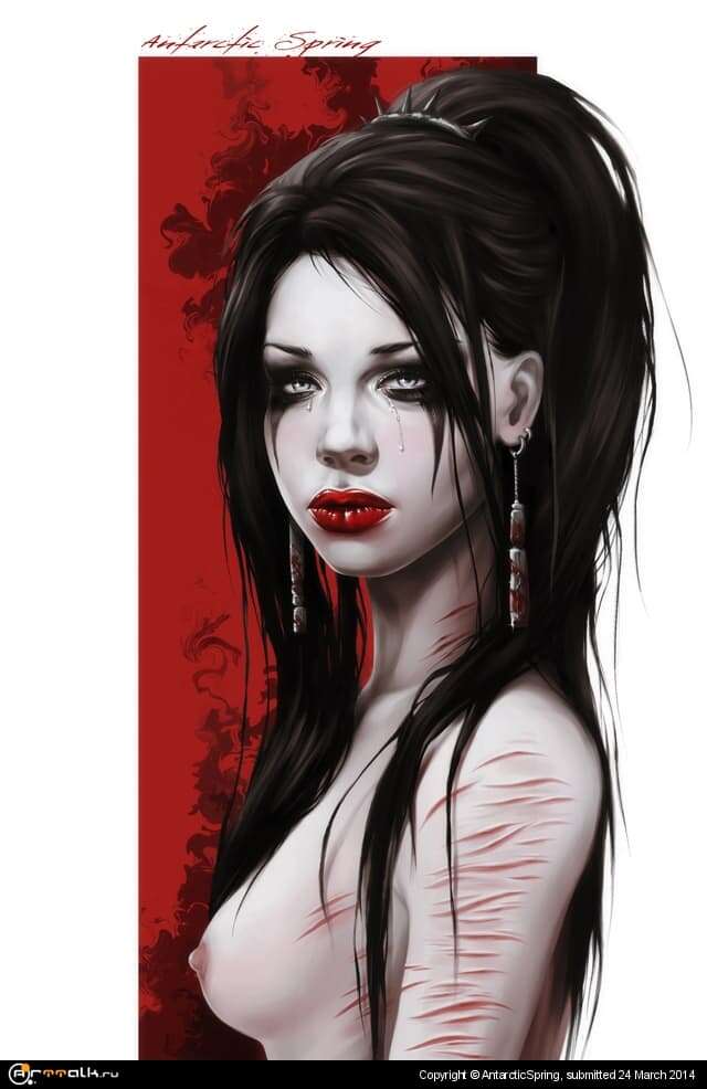 Scars