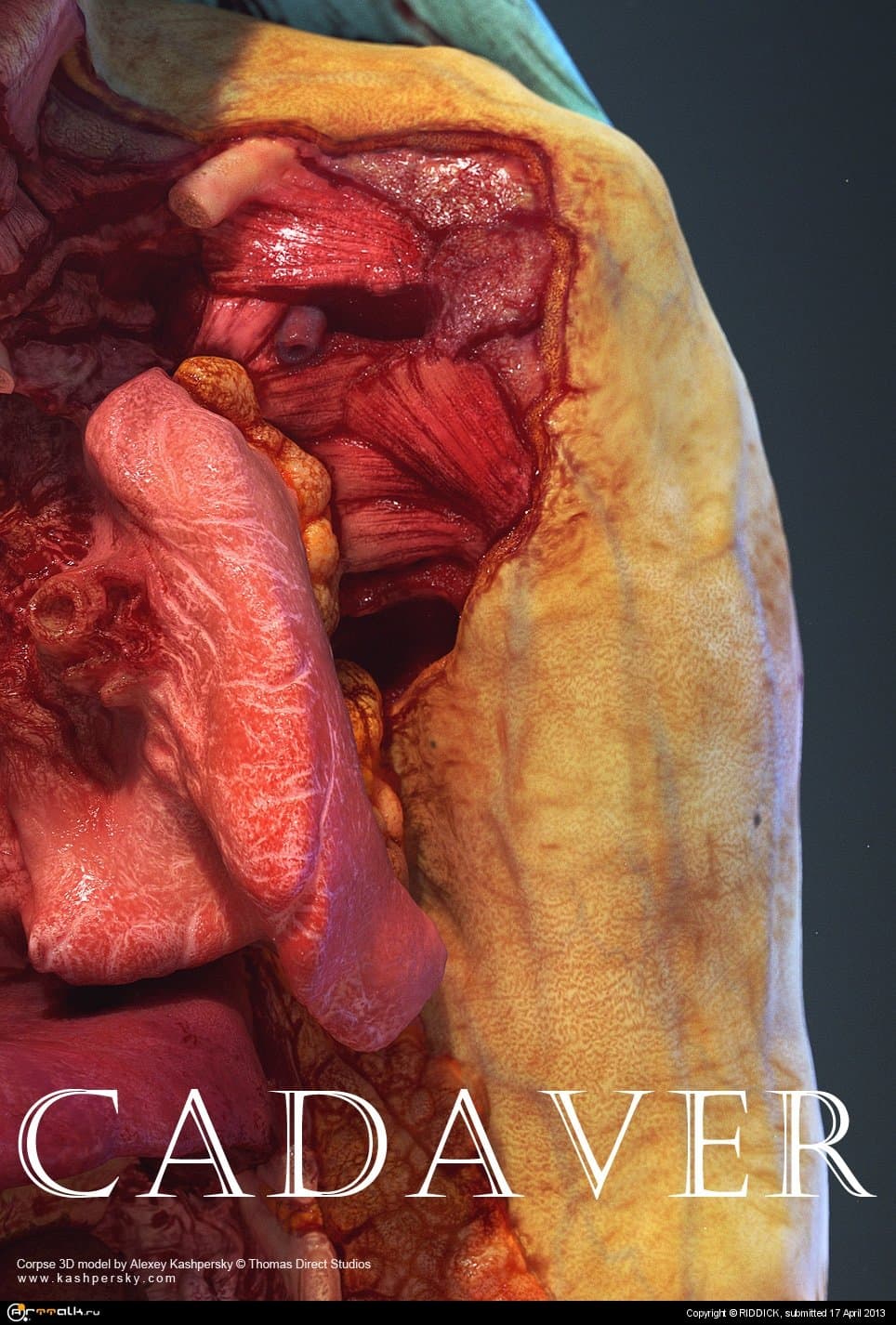 (16+) Human Cadaver 3d Model