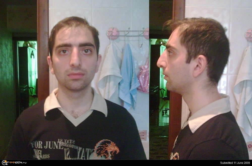 101.thumb.jpg.da5c1d20c64d95694182837e8f2bbd24.jpg